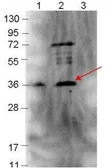 Anti-Borrelia burgdorferi p39 antibody used in Western Blot (WB). GTX48801