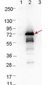 Anti-Borrelia burgdorferi Osp A antibody used in Western Blot (WB). GTX48804