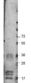Anti-VEGFA antibody used in Western Blot (WB). GTX48811