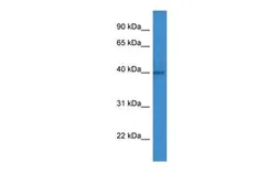 Anti-ART1 antibody, C-term used in Western Blot (WB). GTX48930