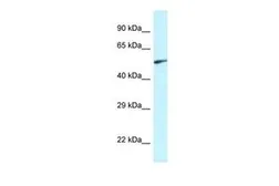 Anti-EYA2 antibody, Internal used in Western Blot (WB). GTX48947