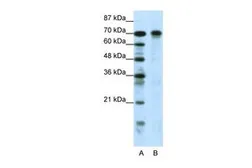 Anti-HIC1 antibody, N-term used in Western Blot (WB). GTX48948