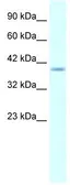 Anti-HMX1 antibody, Internal used in Western Blot (WB). GTX48950