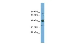 Anti-FOXQ1 antibody, N-term used in Western Blot (WB). GTX48977