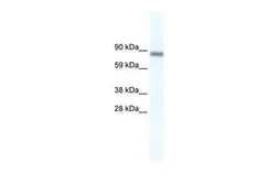 Anti-p66 alpha antibody, N-term used in Western Blot (WB). GTX48987