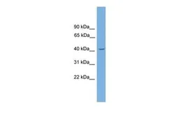 Anti-GATA5 antibody, N-term used in Western Blot (WB). GTX48995