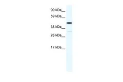 Anti-HOXA3 antibody, N-term used in Western Blot (WB). GTX48996