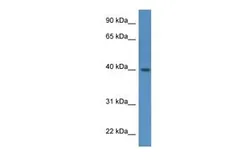 Anti-ELMOD3 antibody, C-term used in Western Blot (WB). GTX49049