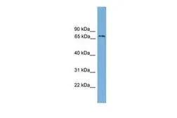 Anti-Ifi204 antibody, Internal used in Western Blot (WB). GTX49075
