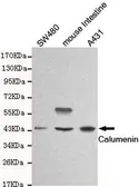 Anti-Calumenin antibody [4C6-G10-B12] used in Western Blot (WB). GTX49241