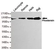 Anti-Phostensin antibody [4B12-E11-D9] used in Western Blot (WB). GTX49266