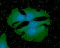 Anti-Podoplanin antibody [5E2] used in Immunocytochemistry/ Immunofluorescence (ICC/IF). GTX50043