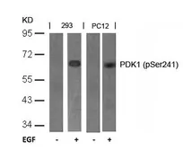 Anti-PDPK1 / PDK1 (phospho Ser241) antibody used in Western Blot (WB). GTX50093