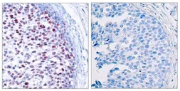 Anti-c-Jun (phospho Thr239) antibody used in IHC (Paraffin sections) (IHC-P). GTX50103
