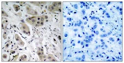 Anti-AKT (phospho Ser473) antibody used in IHC (Paraffin sections) (IHC-P). GTX50128