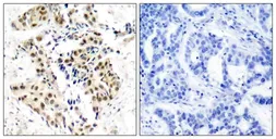 Anti-ATM (phospho Ser1981) antibody used in IHC (Paraffin sections) (IHC-P). GTX50184
