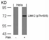 Anti-LIM kinase 2 (phospho Thr505) antibody used in Western Blot (WB). GTX50188