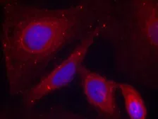 Anti-PAK1 (phospho Thr212) antibody used in Immunocytochemistry/ Immunofluorescence (ICC/IF). GTX50211