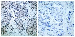 Anti-SEK1 / MKK4 (phospho Thr261) antibody used in IHC (Paraffin sections) (IHC-P). GTX50226