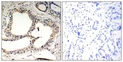 Anti-IKB epsilon (phospho Ser22) antibody used in IHC (Paraffin sections) (IHC-P). GTX50252