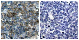 Anti-VASP (phospho Ser157) antibody used in IHC (Paraffin sections) (IHC-P). GTX50253