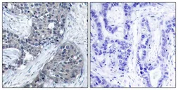 Anti-eIF4E (phospho Ser209) antibody used in IHC (Paraffin sections) (IHC-P). GTX50268