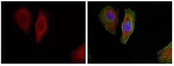Anti-ERK1 (phospho Thr202) + ERK2 (phospho Thr185) antibody used in Immunocytochemistry/ Immunofluorescence (ICC/IF). GTX50274