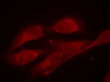 Anti-SHC1 (phospho Tyr317) antibody used in Immunocytochemistry/ Immunofluorescence (ICC/IF). GTX50326