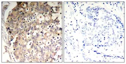 Anti-SHP1 (phospho Tyr536) antibody used in IHC (Paraffin sections) (IHC-P). GTX50327