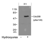 Anti-CDC25B (phospho Ser149) antibody used in Western Blot (WB). GTX50360