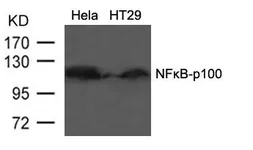 Anti-NFkB p100 antibody used in Western Blot (WB). GTX50375