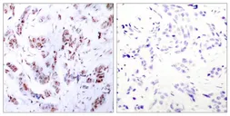 Anti-MEF2A antibody used in IHC (Paraffin sections) (IHC-P). GTX50397
