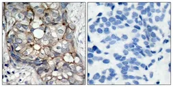 Anti-EGFR antibody used in IHC (Paraffin sections) (IHC-P). GTX50426