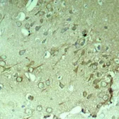 Anti-Tau antibody used in IHC (Paraffin sections) (IHC-P). GTX50445
