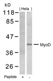 Anti-MyoD1 antibody used in Western Blot (WB). GTX50470