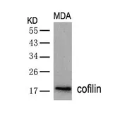 Anti-Cofilin antibody used in Western Blot (WB). GTX50502