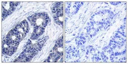 Anti-IRS1 antibody used in IHC (Paraffin sections) (IHC-P). GTX50550