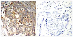 Anti-JNK antibody used in IHC (Paraffin sections) (IHC-P). GTX50564