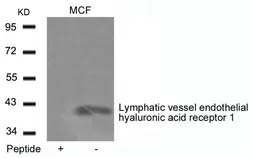 Anti-LYVE1 antibody used in Western Blot (WB). GTX50637