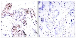 Anti-ELK1 (phospho Ser389) antibody used in IHC (Paraffin sections) (IHC-P). GTX50688