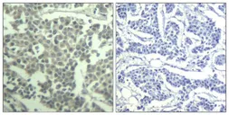 Anti-c-kit (phospho Tyr936) antibody used in IHC (Paraffin sections) (IHC-P). GTX50690