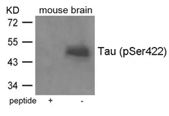 Anti-Tau (phospho Ser422) antibody used in Western Blot (WB). GTX50703