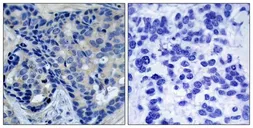 Anti-PYK2 (phospho Tyr402) antibody used in IHC (Paraffin sections) (IHC-P). GTX50713