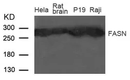 Anti-Fatty Acid Synthase antibody used in Western Blot (WB). GTX50788