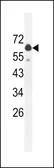 Anti-GLS2 antibody used in Western Blot (WB). GTX50889