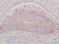 Anti-ABCA12 antibody used in IHC (Paraffin sections) (IHC-P). GTX51202