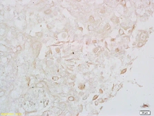 Anti-LONP1 antibody used in IHC (Paraffin sections) (IHC-P). GTX51596