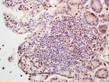 Anti-SETBP1 antibody used in IHC (Paraffin sections) (IHC-P). GTX51616
