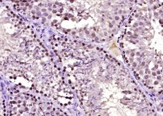 Anti-DNAJB4 antibody used in IHC (Paraffin sections) (IHC-P). GTX51675