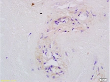 Anti-MFSD2A antibody used in IHC (Paraffin sections) (IHC-P). GTX51685